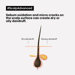 L’Oréal Professionnel Scalp Advanced Anti-Discomfort Intense Soother Treatment | Salon Grade Treatment For Sensitive Scalps | Enriched with Niacinamide | Soothes & Hydrates the Scalp |with Niacinamide | 300 ml