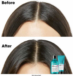 L’Oréal Professionnel Scalp Advanced Anti-Discomfort Treatment | Salon Grade Treatment For Sensitive Scalps | Enriched with Niacinamide | 200 ml