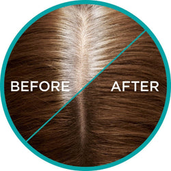 L’Oreal Paris Magic Retouch Instant Root Concealer Spray, Shade: Brown, for Quick Grey Coverage, Easy Application, Natural Finish, Scalp Coverage, Suitable for All Hair Colours, 75ml