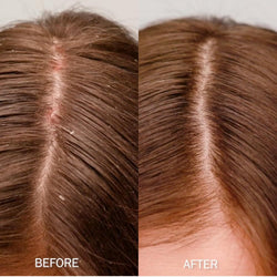 Sachajuan Scalp Shampoo, 250 milliliters